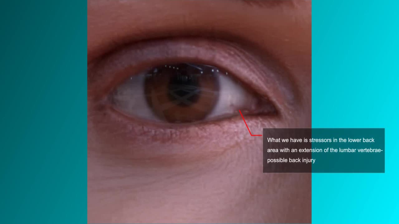 See What The Whites of Your Eyes is Saying About Your Health|ORDER TODAY!