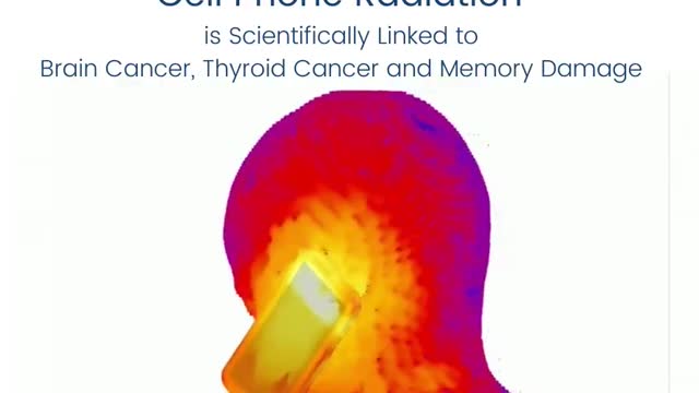 Cell Phone radiation causes cancer and memory damage