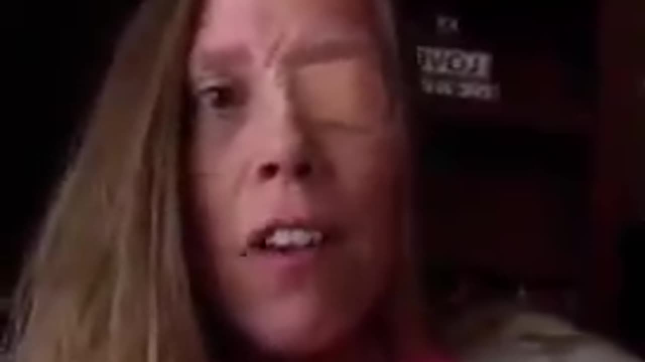 7 months with Bell’s palsy from the jab & her drs are lying to her