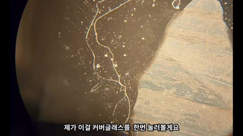논란의 생리식염수 현미경