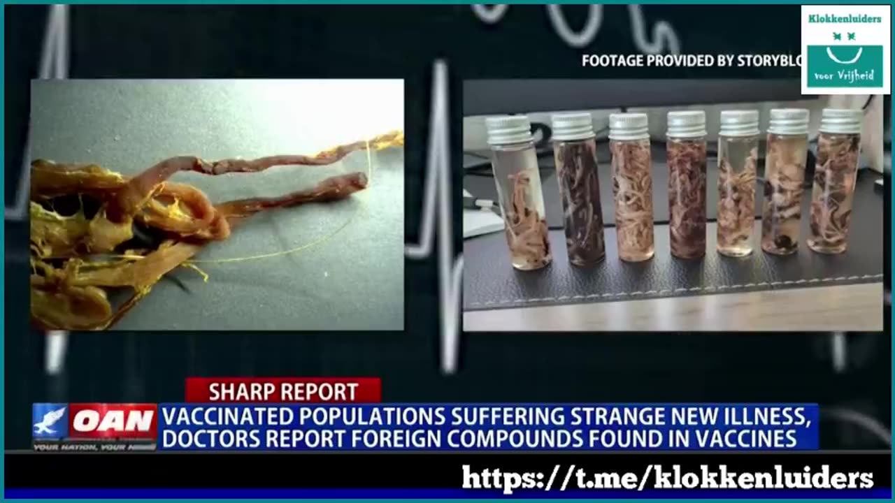 Covid Vaccinated Populations Suffering strange new illness