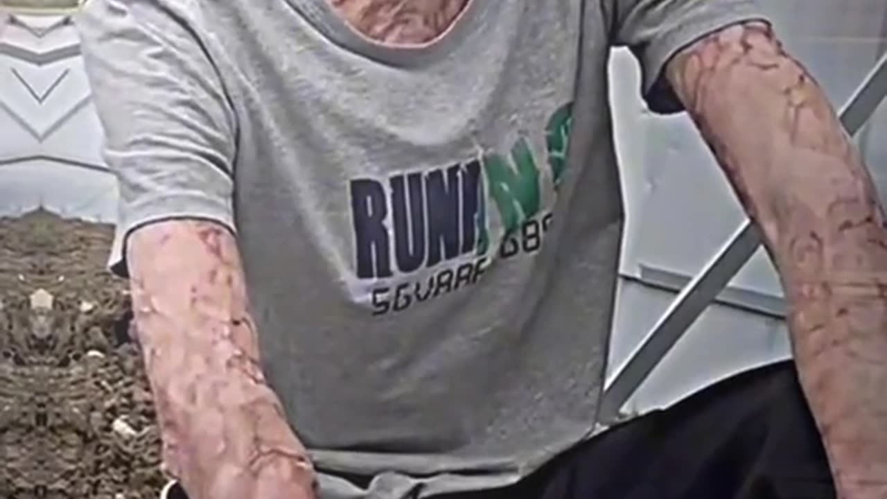 This guy burn himself to safe his daughter 😭😭