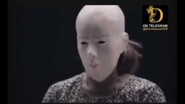אחלה זריקות