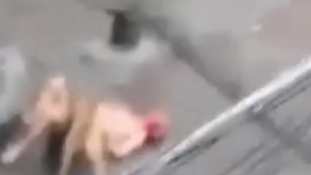 😭Hazardous dogs attack's on streets, 😭bite's Humans & Kids #001#shorts