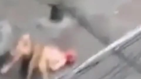 😭Hazardous dogs attack's on streets, 😭bite's Humans & Kids #001#shorts