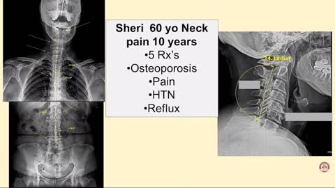 Bone Health w/Dr.B