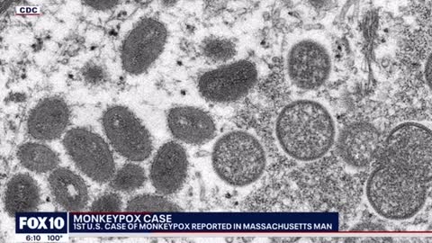 US buys millions of Moneypox vaccines after Massachusetts confirms cases