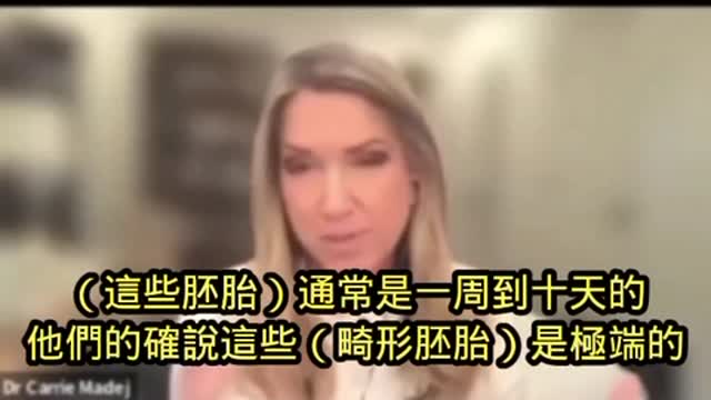 Dr. Carrie Madej 受訪談及近期出生的嬰兒不喝母乳,一個已針者母乳化驗病例,以及體外受孕的胚胎…