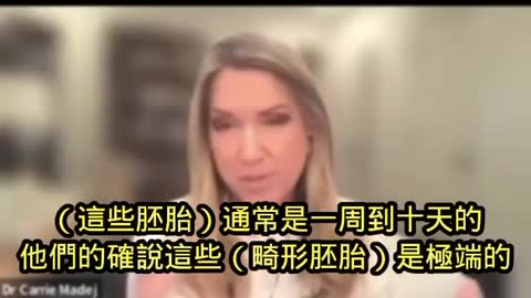 Dr. Carrie Madej 受訪談及近期出生的嬰兒不喝母乳，一個已針者母乳化驗病例，以及體外受孕的胚胎…