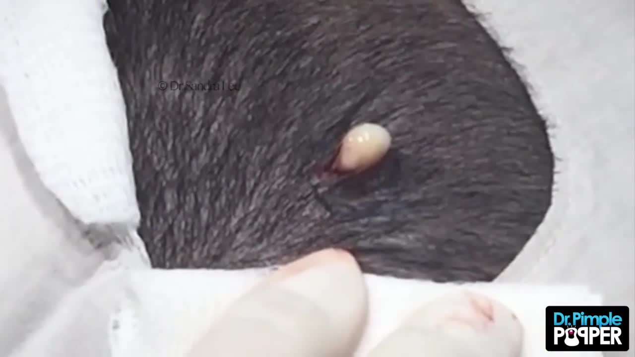 How many Cyst-ers are on this Scalp?!