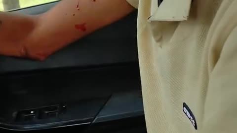 Horrifying Car Crash | Blood | In Tiago