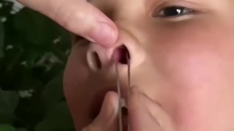 Man removing coin from nose..