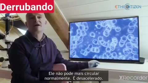 How does the blood look on vaccinated people (Portugues)