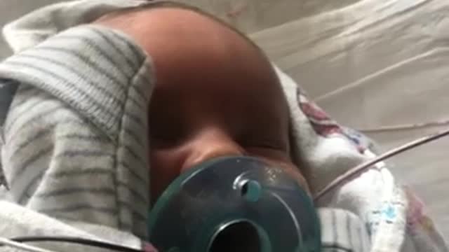 He just got circumcised