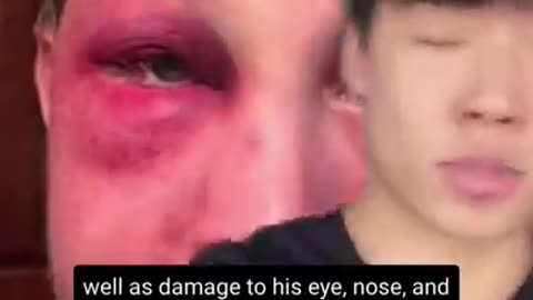 He Was Beaten Up For This…