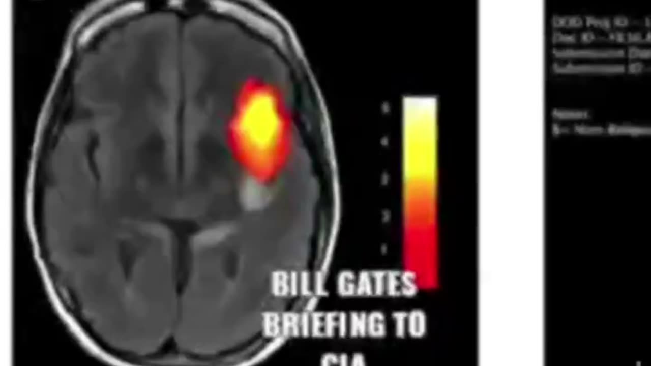 SECRET PRESENTATION TO CIA, BILL GATES IS TALKING ABOUT HOW TO CONTROL BRAIN WITH DRUGS & VACCINES