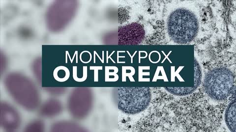 VERIFY: Fact-checking common claims about the monkeypox virus