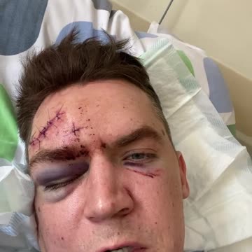 Dr. Szarpanki został brutalnie pobity przez imigrantów. Trzymaj się doctore!