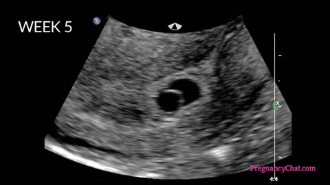 Development of a foetus or a baby inside a womb