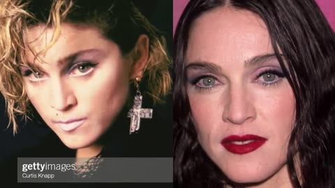 Madonna Plastic Surgeries - Surgeon Reacts