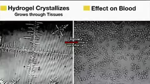 ⚠️🔥DARPA Hydrogel Nanoparticles🧬 in Test Swabs🔥