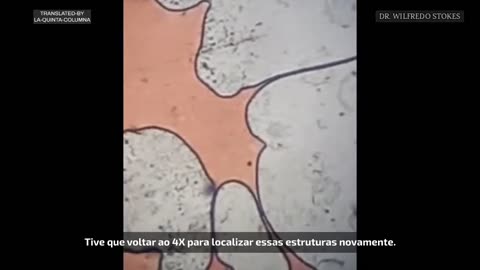 Paciente masculino de 10 anos. Inoculado com 2 doses de Moderna e 2 testes PCR.