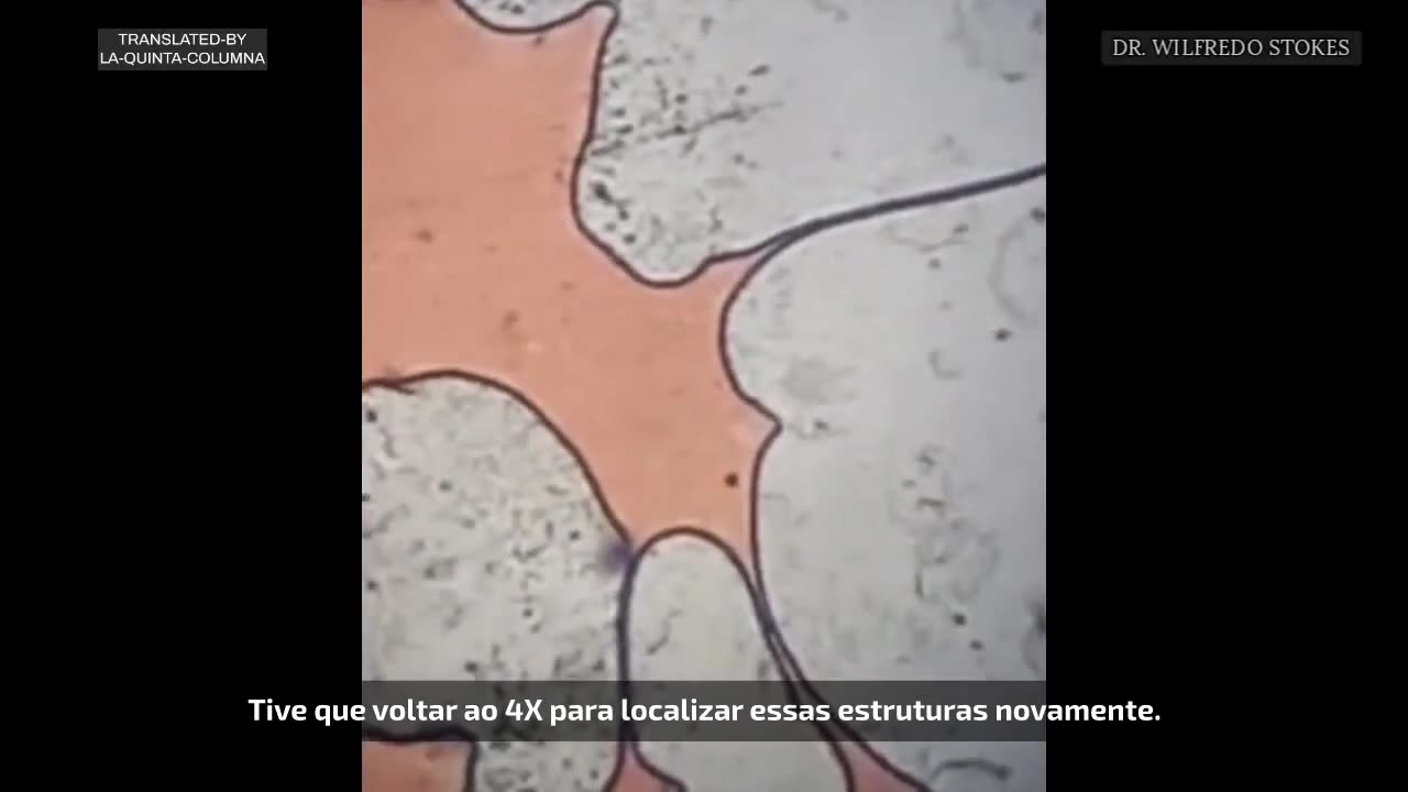 Paciente masculino de 10 anos. Inoculado com 2 doses de Moderna e 2 testes PCR.