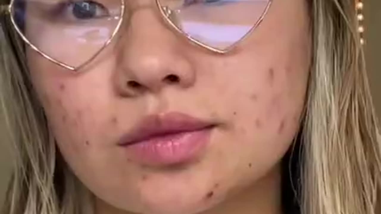 How treat skin infections or ache or rashes or pimples