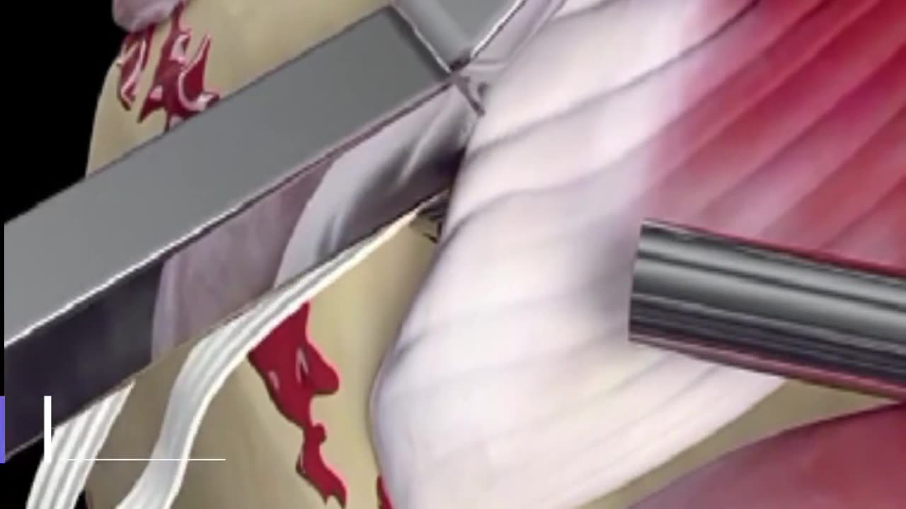 how to fix shoulder bond #shorts