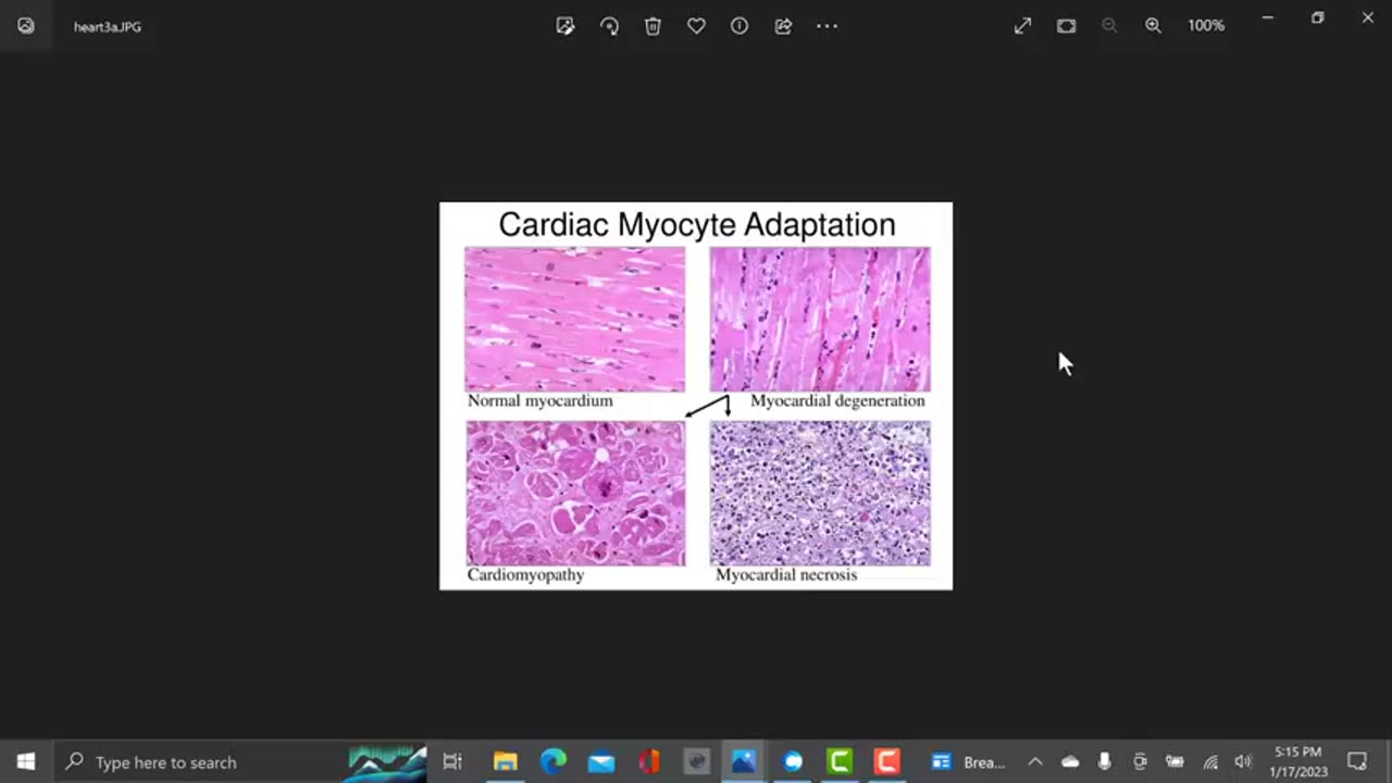 VACCINE INGREDIENT CESIUM 137