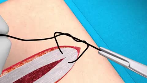 Practical suturing techniques animated demonstrations