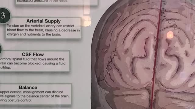 Is your head on straight?