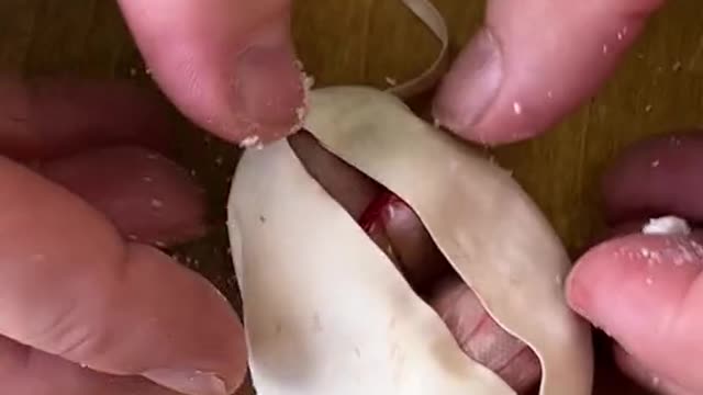 Welcome to the world little one! It is called that because