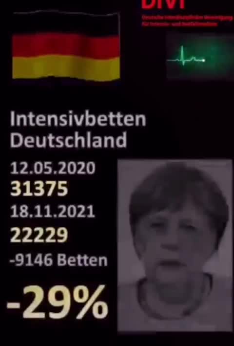 Number of hospital intensive care beds - how downsized.