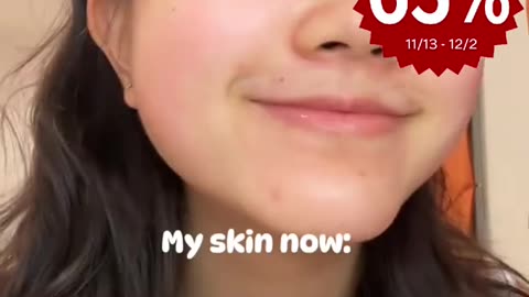 To achieve your ideal skin