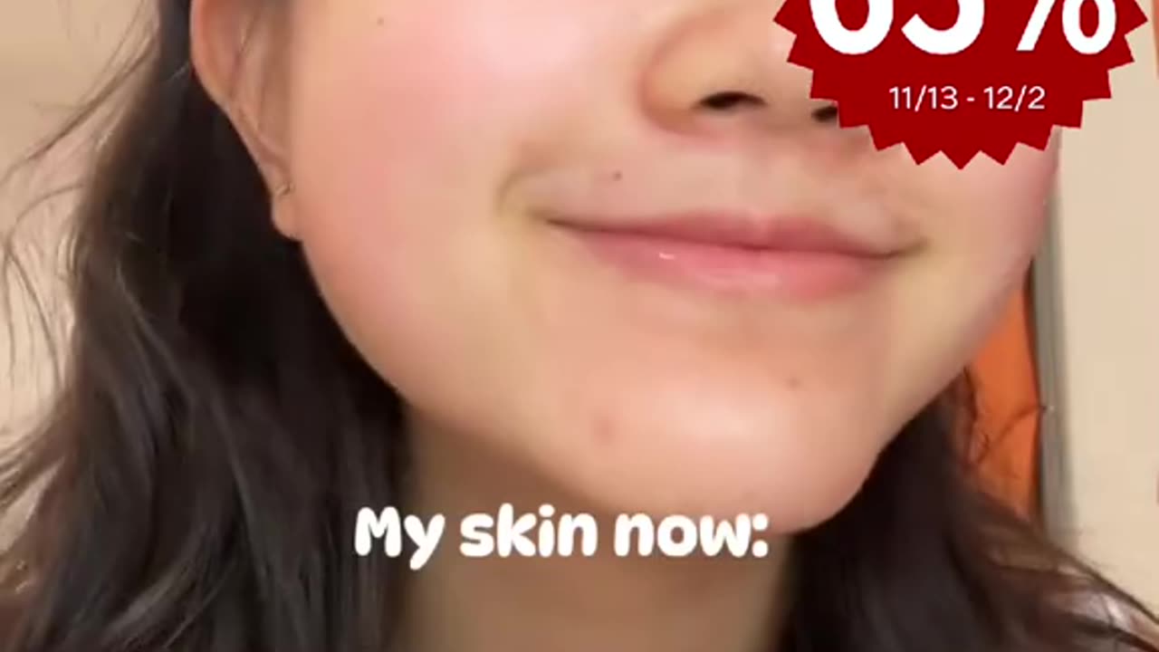 To achieve your ideal skin