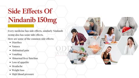 Get Nindanib 150 mg Online for a Reasonable Price