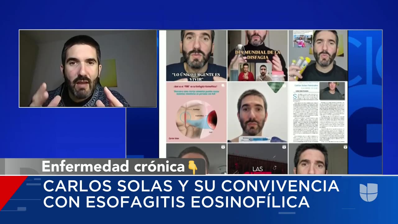 Hispano cuenta cómo es vivir con una enfermedad que le dificulta comer: por un bocado podría morir