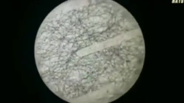 Microscope reveals graphene fibres being placed into tampons - 10-19-22