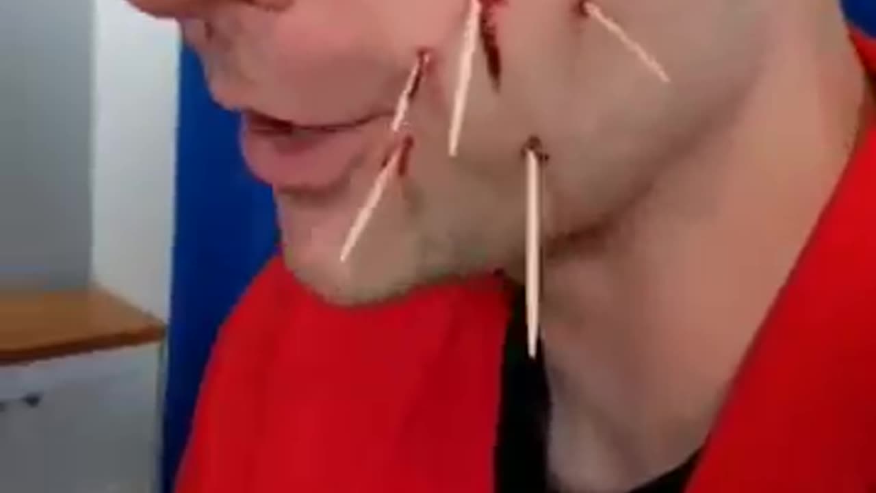 Toothpick Accident ##shorts