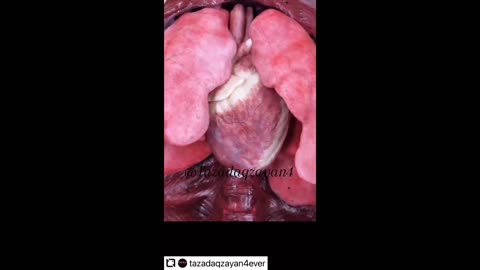 Effects of the 🥕💉💉