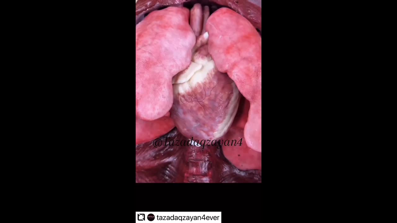 Effects of the 🥕💉💉