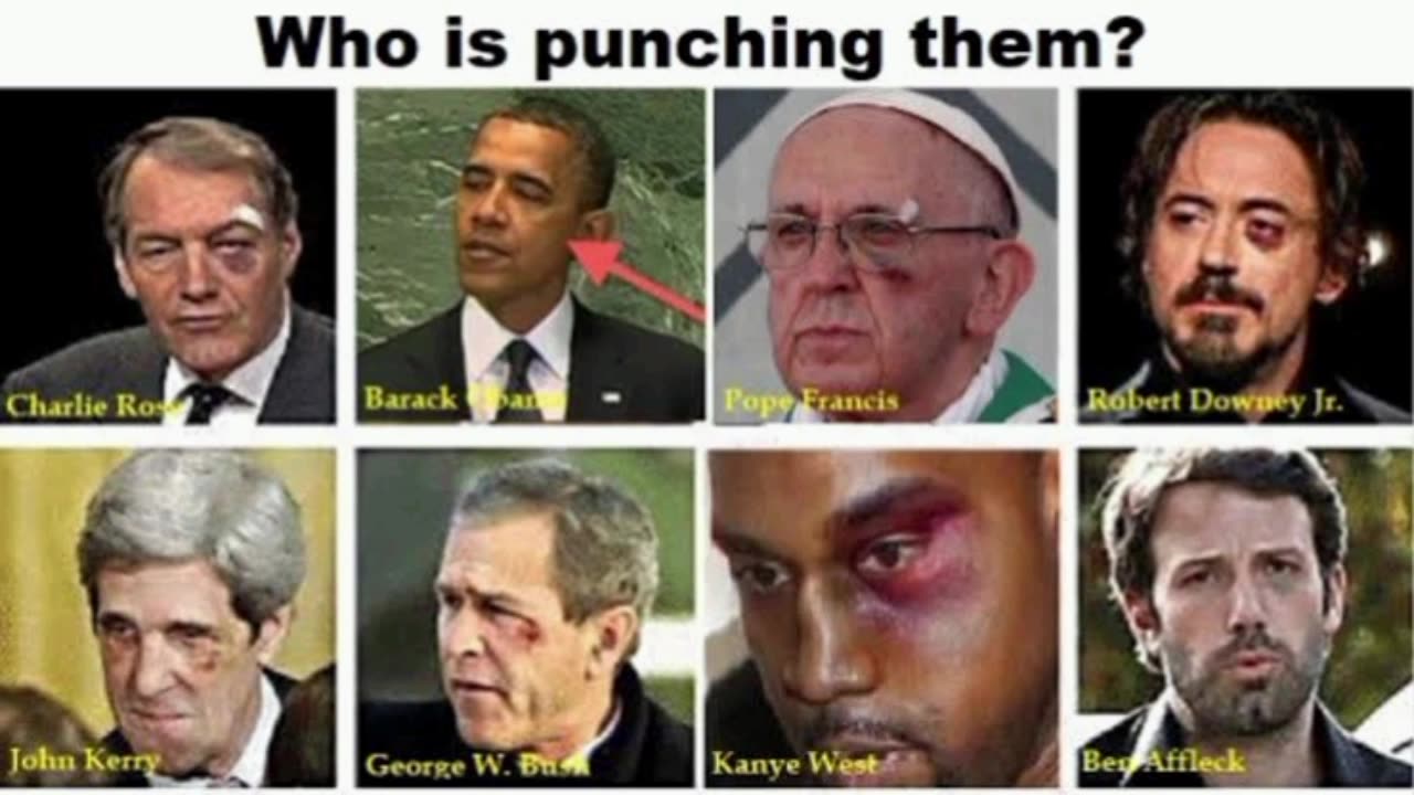 Welcome to the black eye club