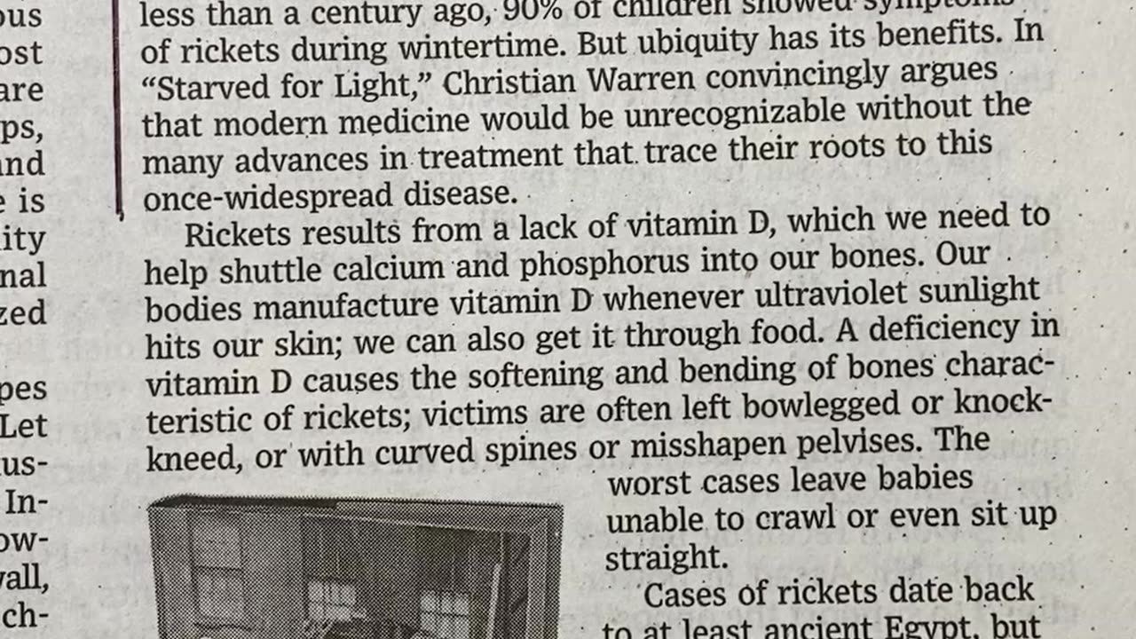 #MurphDocU: #new-book on #rickets #Vitamin-D & the #history-of-medicine