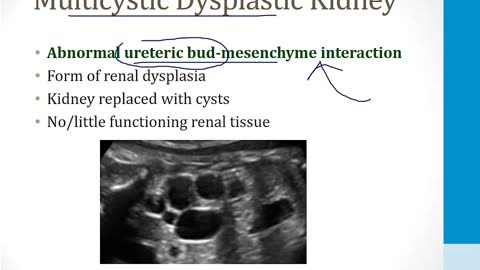 Renal - 1. Embryology, Anatomy and Physiology - 1.Renal Embryology