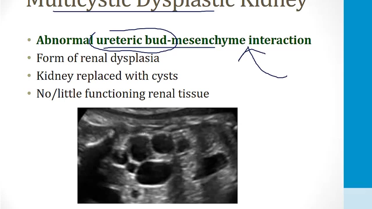 Renal - 1. Embryology, Anatomy and Physiology - 1.Renal Embryology