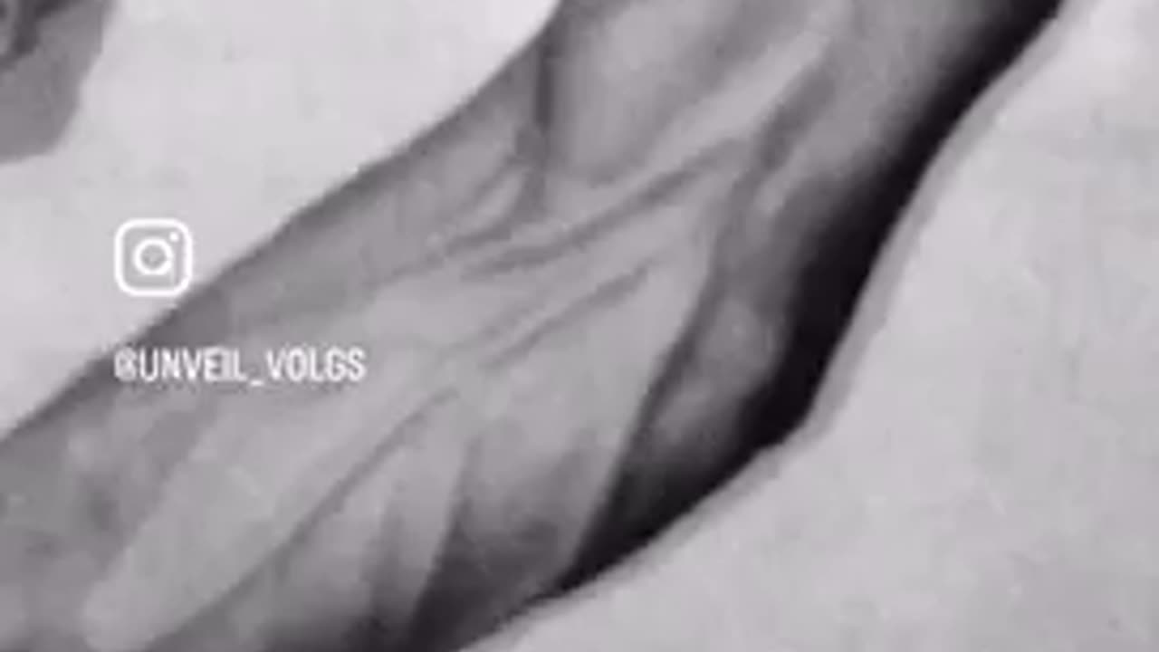 Getting little vascular