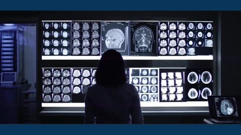 IBM researchers bring AI to radiology