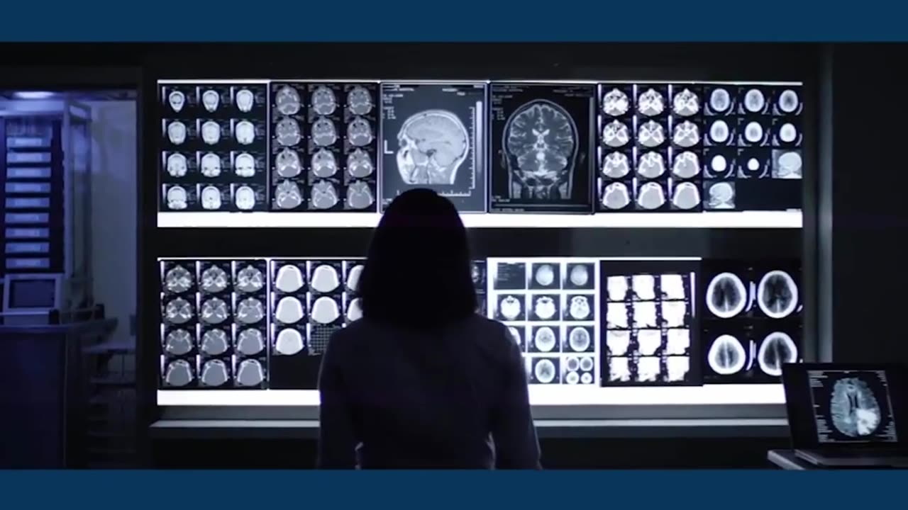 IBM researchers bring AI to radiology