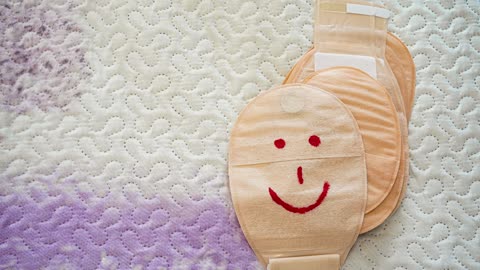 Unveiling the Comfort Revolution: Dive into the World of Ostomy Liners!